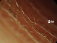 毫丝尽显 美妙无比 这是显微镜下的世界丨观海视觉