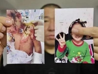 抚顺市回应6岁女童受虐案：依法从重从快严惩犯罪分子