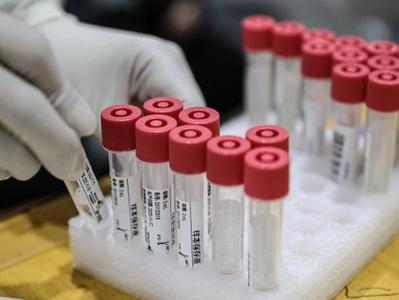 世卫组织：全球新冠确诊病例超1亿零208万例，死亡病例超220万