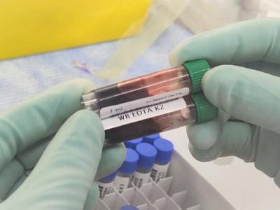 警惕！广州海关查获走私人体血液样本，部分检出登革病毒