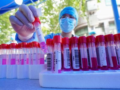 国家卫健委：我国新冠病毒核酸检测能力达单管每日5700万管