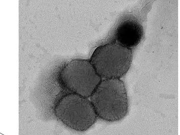 国药集团中国生物成功分离猴痘病毒，并开始疫苗药物相关研究