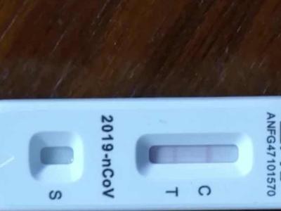 抗原红线深浅能代表病情轻重吗？解答来了