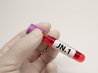JN.1成为欧美流行新冠毒株，会引起更严重症状吗？