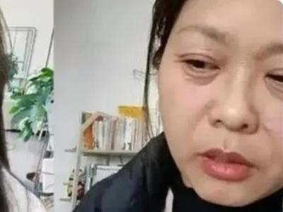 20天容貌老了30多岁？女子自称“断崖式衰老”！关注人生3个衰老转折点 