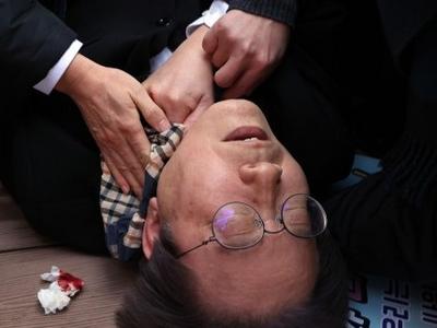 首尔大学医疗小组：李在明左侧颈内静脉60%被切断，术后状态“还有待观察”