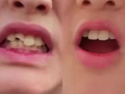 小学生磕掉5颗恒牙，老师第一时间把牙放进鲜奶中？