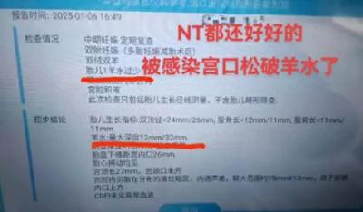南昌9胞胎女子最后两胎没保住，丈夫：感染严重只能保大弃小