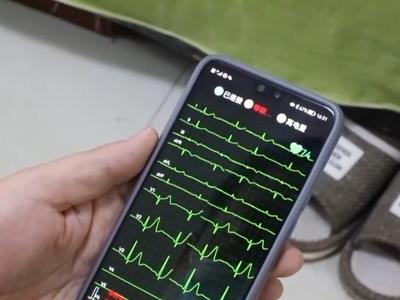 心脏支架手术将逐步被淘汰？真相来了→