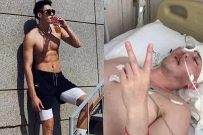 确诊后他3次开颅！曾经的帅小伙“容貌尽毁”，最新消息……