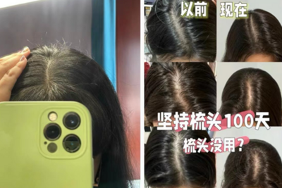 经常梳头vs不怎么梳头，到底哪种更健康？