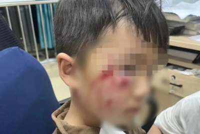 警惕犬只伤人，被犬袭击后这样处理→