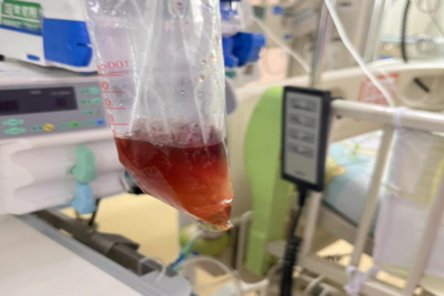 吃了一包零食，5岁娃进了ICU！这病南方高发，很多家长不知道