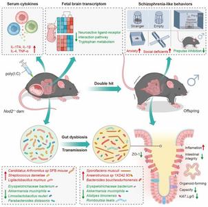 精神分裂症的发生与肠道微生物紊乱相关？研究揭示作用机制