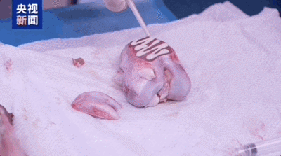 “骨胶水”来了，断骨黏合只需3分钟