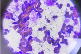 根除幽门螺杆菌，我国科学家给出全新答案！