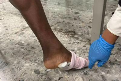 海关查获进境旅客脚底藏匿大麻2包，毛重17.6克