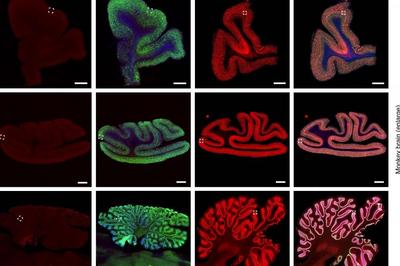 《自然》发表中国研究成果：修复大脑里一个“错字” 孤独症小鼠恢复了正常