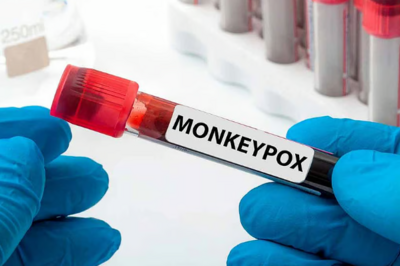 刚果（金）宣布猴痘疫情结束