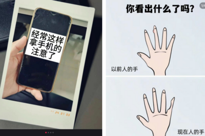 第一批用小拇指做“手机支架”的受害者出现了？医生提醒→