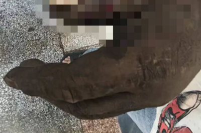 大爷被眼镜蛇咬伤，老伴效仿影视剧“用嘴吸出毒液”，双双紧急送医抢救