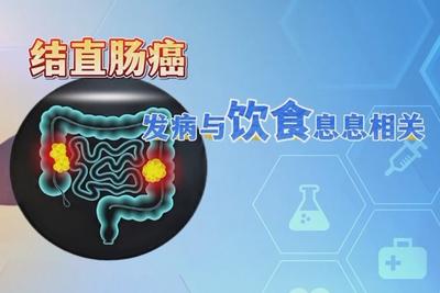 “肠癌”发现就是中晚期？身体这些信号千万别忽视 
